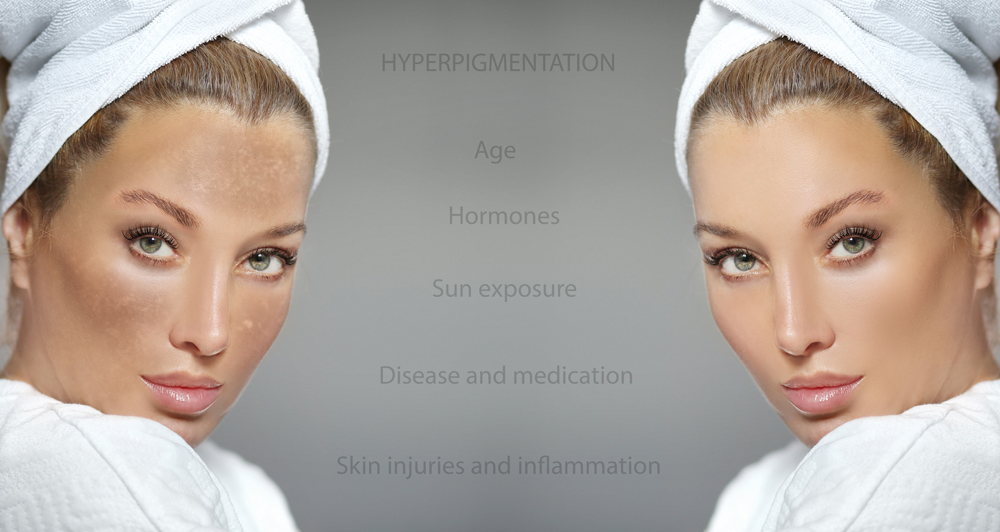 Beauty treatments in Bradford | Sam Noor Studios gallery image 3